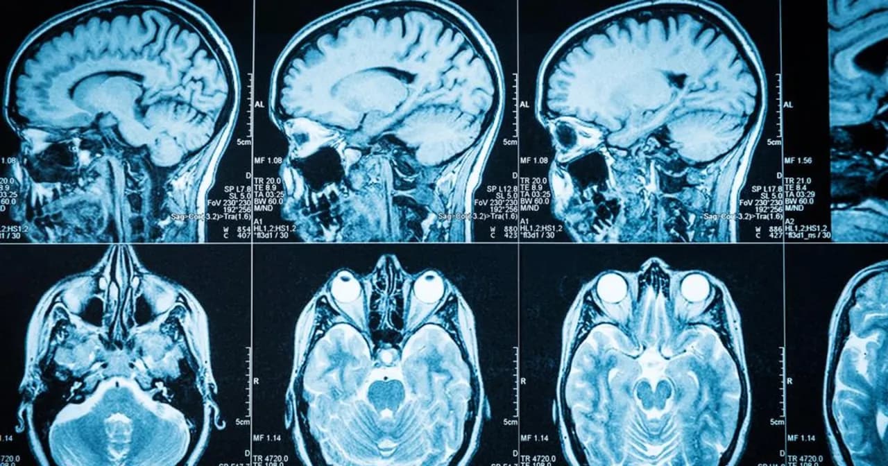 Guz mózgu objawy psychiczne: jak rozpoznać niebezpieczne sygnały