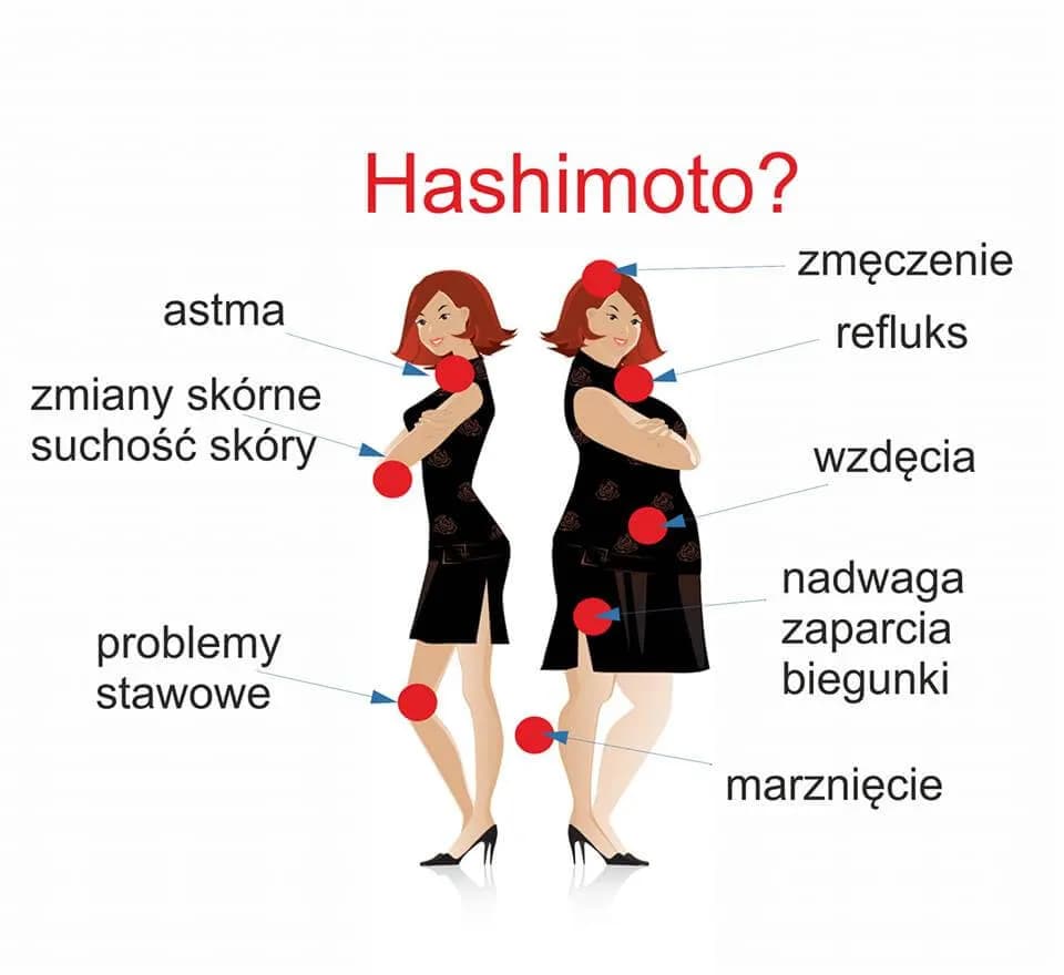 Hashimoto objawy psychiczne - jak rozpoznać i zrozumieć ich wpływ