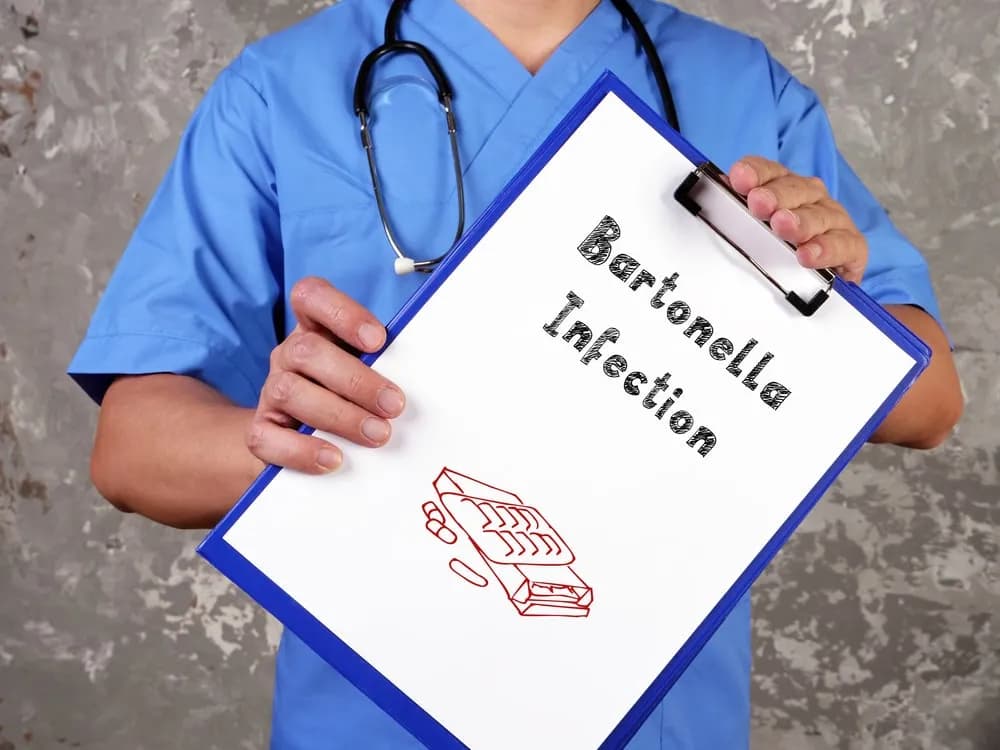 Bartonella objawy psychiczne: Jak infekcja wpływa na zdrowie psychiczne